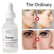 The Ordinary Niacinamide 10% + Zinc 1% - 30ml (Buy 1 Get 1 Free)