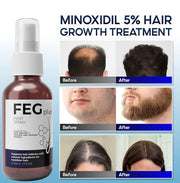 FEG PLUS -58% FEG PLUS Hair Growth Spray